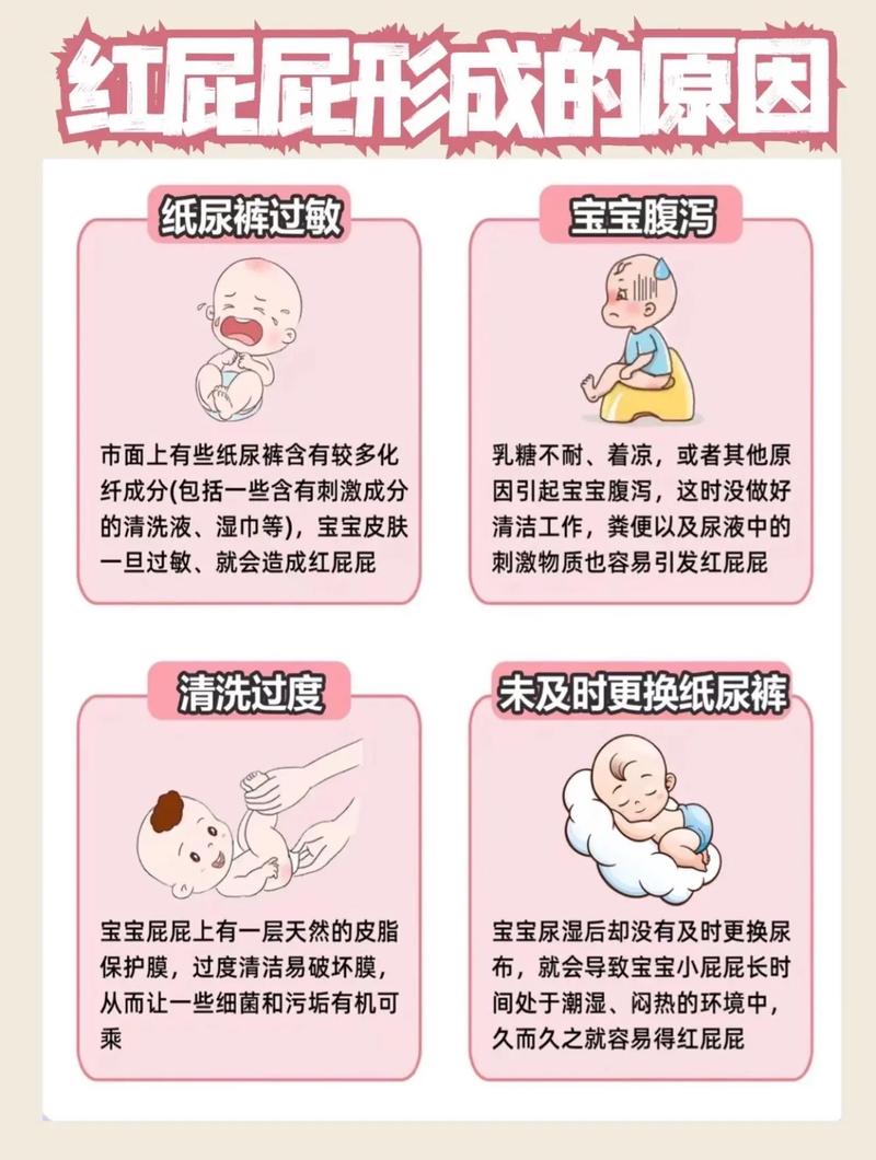 新生儿屁股湿疹反反复复，到底该怎么护理才能好得快？-第3张图片-郑州医学网