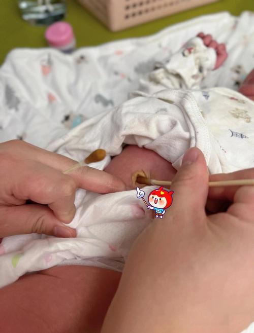 新生儿肚脐根部未脱落，家长该如何正确护理与观察呢？-第1张图片-郑州医学网