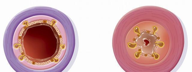 孕期38周分泌物增多是临产征兆还是异常情况？-第2张图片-郑州医学网