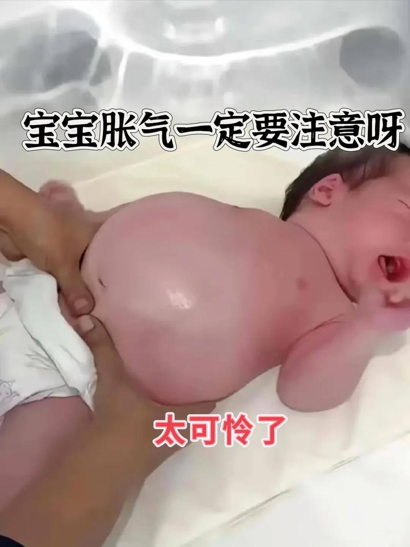 新生儿都会出现胀气吗？胀气原因与缓解方法有哪些？-第1张图片-郑州医学网