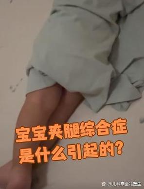 儿童夹腿综合症能好吗-第1张图片-郑州医学网