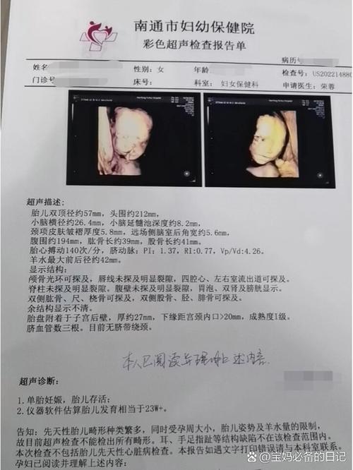 怀孕期间四维检查到底需要做几次才够？不同孕周安排有何讲究？-第3张图片-郑州医学网