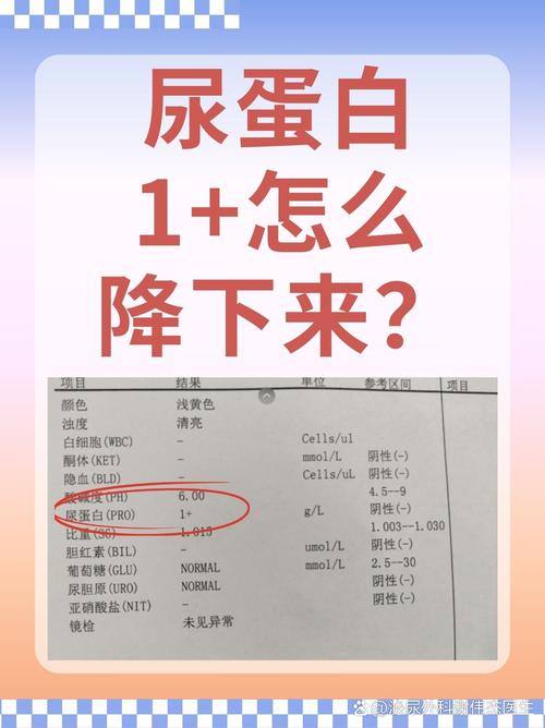 儿童尿钙与尿肌酐比值异常意味着什么?对健康有何影响?-第1张图片-郑州医学网 儿童尿钙与尿肌酐比值异常意味着什么?对健康有何影响?-第1张图片-郑州医学网