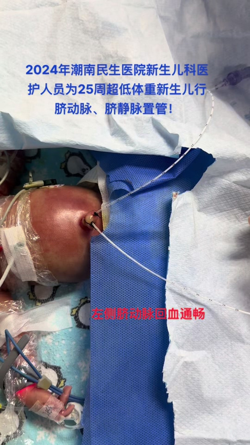 新生儿肚皮血管明显是正常现象吗？需要担心哪些健康问题？-第1张图片-郑州医学网