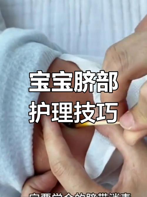 新生儿脐带用酒精消毒是最佳选择吗？会不会刺激宝宝皮肤？-第2张图片-郑州医学网