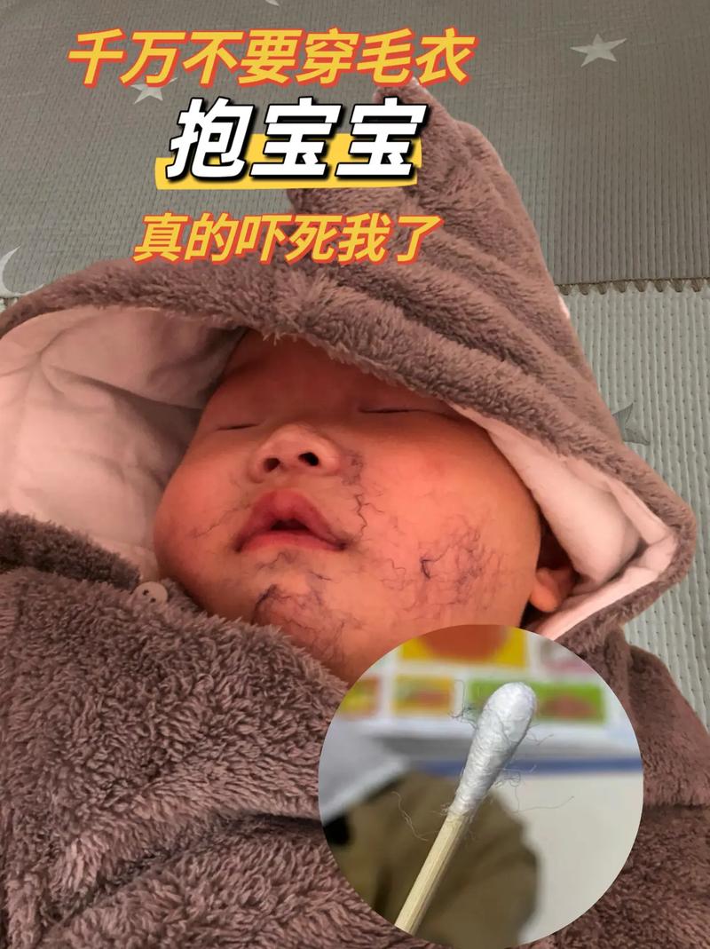 新生儿也会做噩梦大哭吗?原因与应对方法是什么?-第1张图片-郑州医学网 新生儿也会做噩梦大哭吗?原因与应对方法是什么?-第1张图片-郑州医学网