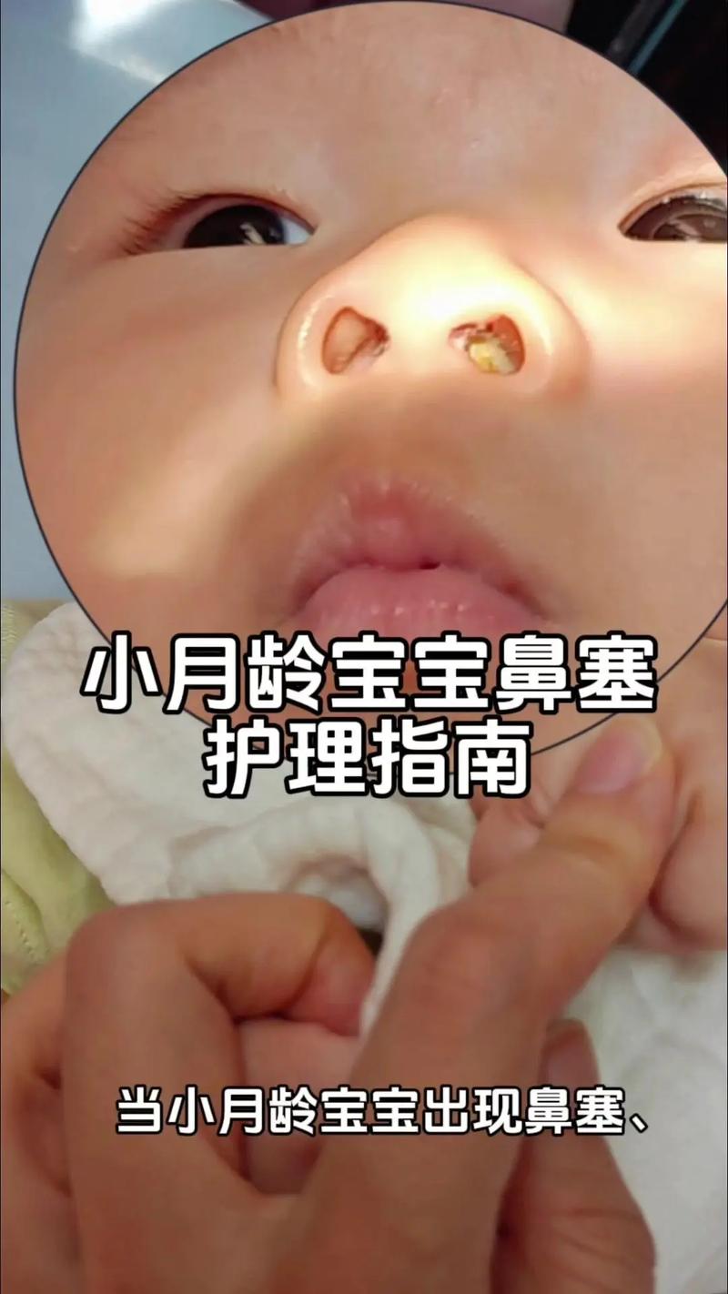 新生儿鼻塞严重睡不好，到底该怎么办才能缓解？-第3张图片-郑州医学网