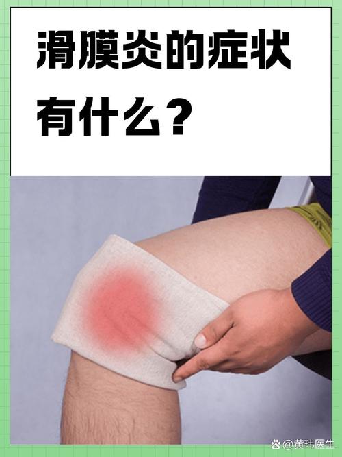 儿童髋关节滑膜炎有哪些典型症状?家长如何早期识别与应对?-第2张图片-郑州医学网 儿童髋关节滑膜炎有哪些典型症状?家长如何早期识别与应对?-第2张图片-郑州医学网