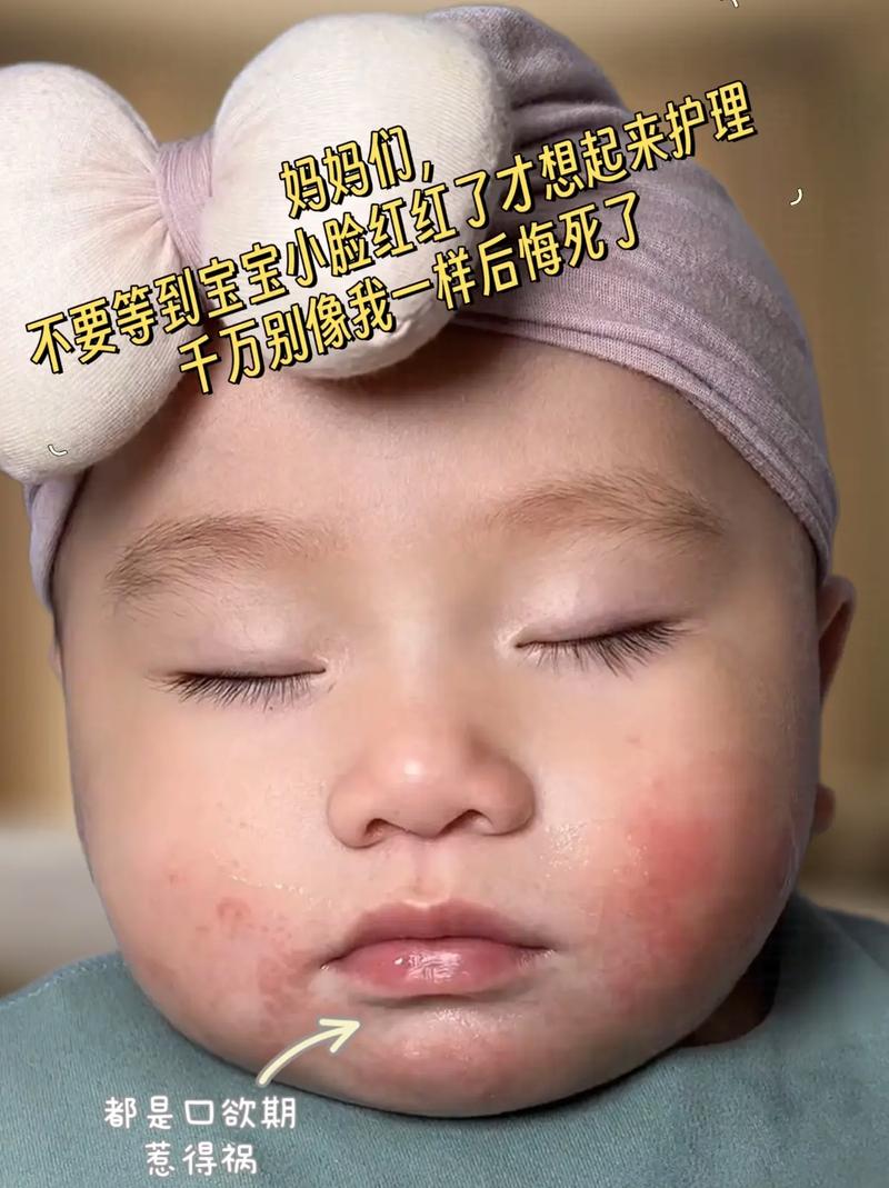 新生儿下巴频繁抖动是正常现象还是异常信号？需警惕哪些潜在健康问题？-第2张图片-郑州医学网