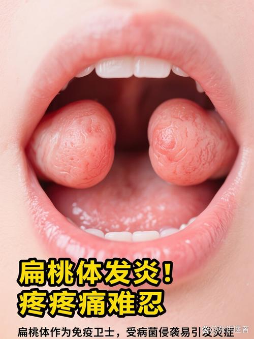 儿童扁桃体大小图怎么看?不同年龄段正常范围是多少?-第2张图片-郑州医学网 儿童扁桃体大小图怎么看?不同年龄段正常范围是多少?-第2张图片-郑州医学网