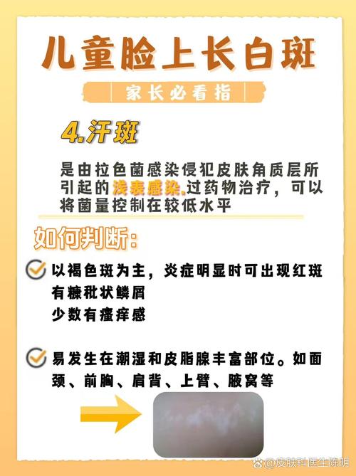 儿童脸上出现白斑是白癜风还是其他皮肤病?家长该如何科学应对?-第2张图片-郑州医学网 儿童脸上出现白斑是白癜风还是其他皮肤病?家长该如何科学应对?-第2张图片-郑州医学网