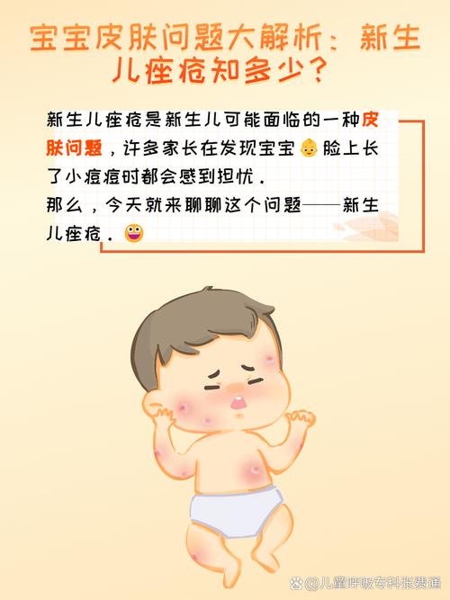 新生儿痤疮和婴儿痤疮是一回事吗?该如何区分护理?-第3张图片-郑州医学网 新生儿痤疮和婴儿痤疮是一回事吗?该如何区分护理?-第3张图片-郑州医学网