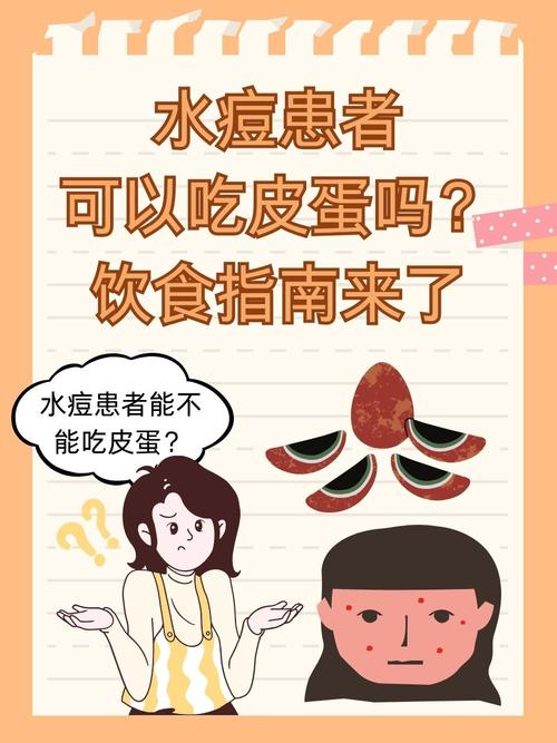 儿童长水痘期间饮食禁忌有哪些？这些食物吃了会加重病情吗？-第2张图片-郑州医学网