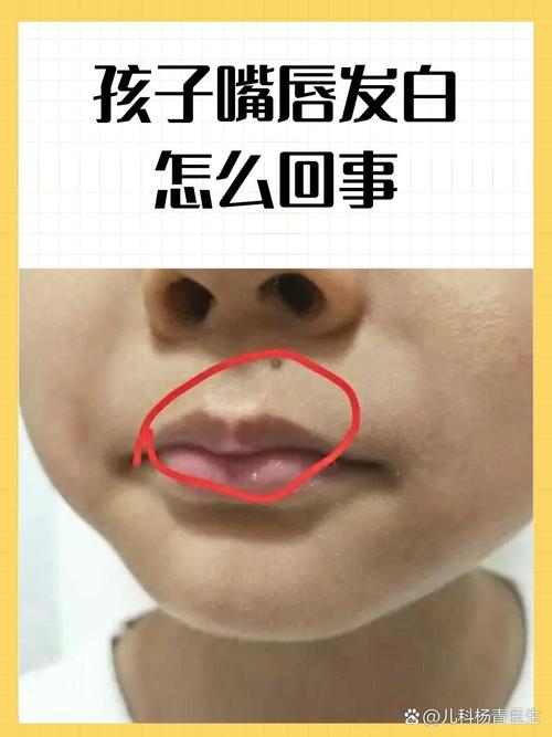 新生儿嘴唇发白是缺氧还是贫血？新手爸妈该如何应对？-第1张图片-郑州医学网
