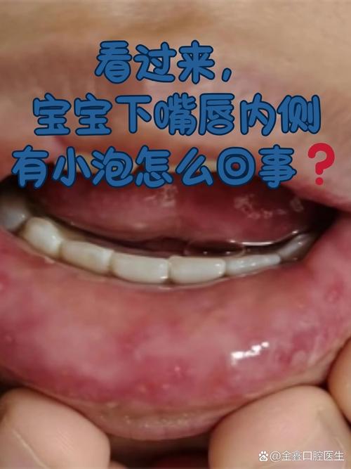 新生儿嘴唇发白是缺氧还是贫血？新手爸妈该如何应对？-第3张图片-郑州医学网
