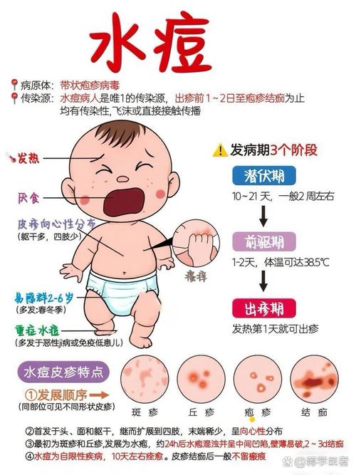 儿童出水痘初期症状有哪些典型表现?家长该如何及时识别与应对?-第2张图片-郑州医学网 儿童出水痘初期症状有哪些典型表现?家长该如何及时识别与应对?-第2张图片-郑州医学网