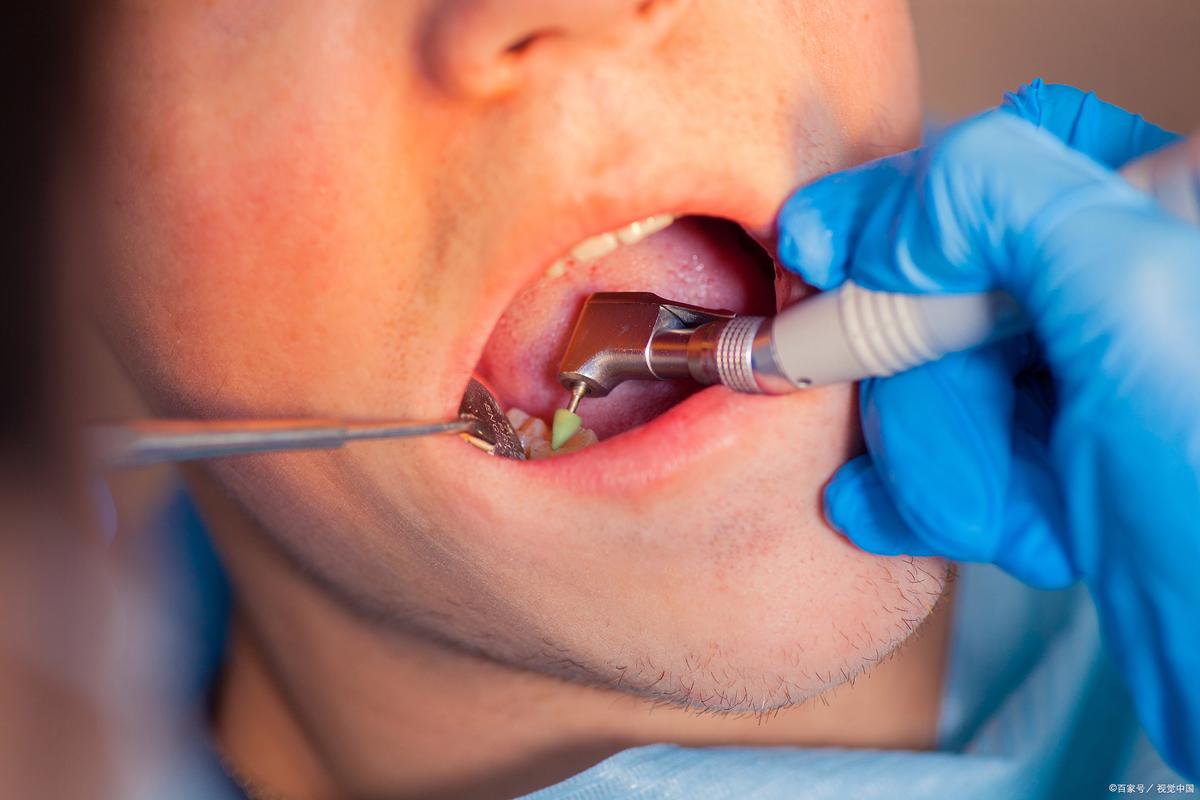 儿童全麻拔牙安全吗？风险与家长最该关注的注意事项有哪些？-第1张图片-郑州医学网