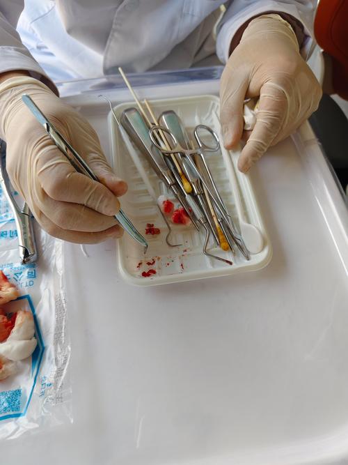 儿童全麻拔牙安全吗？风险与家长最该关注的注意事项有哪些？-第2张图片-郑州医学网