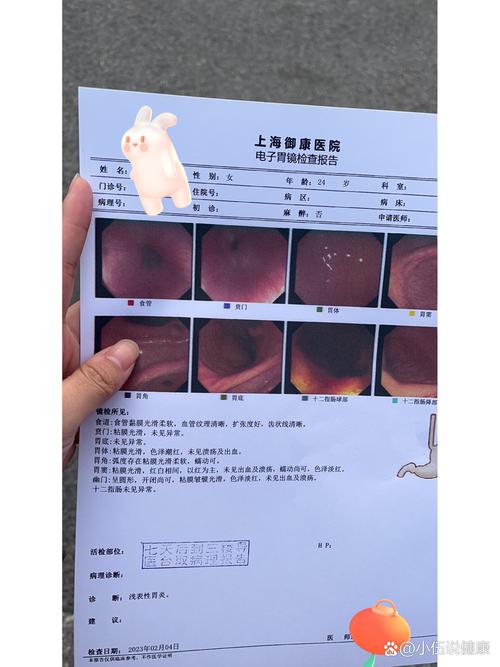 怀孕期间胃镜检查安全吗？对胎儿有影响吗？-第3张图片-郑州医学网