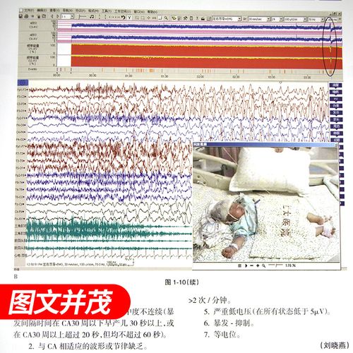 新生儿振幅整合脑电图如何精准评估脑功能发育异常?-第1张图片-郑州医学网 新生儿振幅整合脑电图如何精准评估脑功能发育异常?-第1张图片-郑州医学网