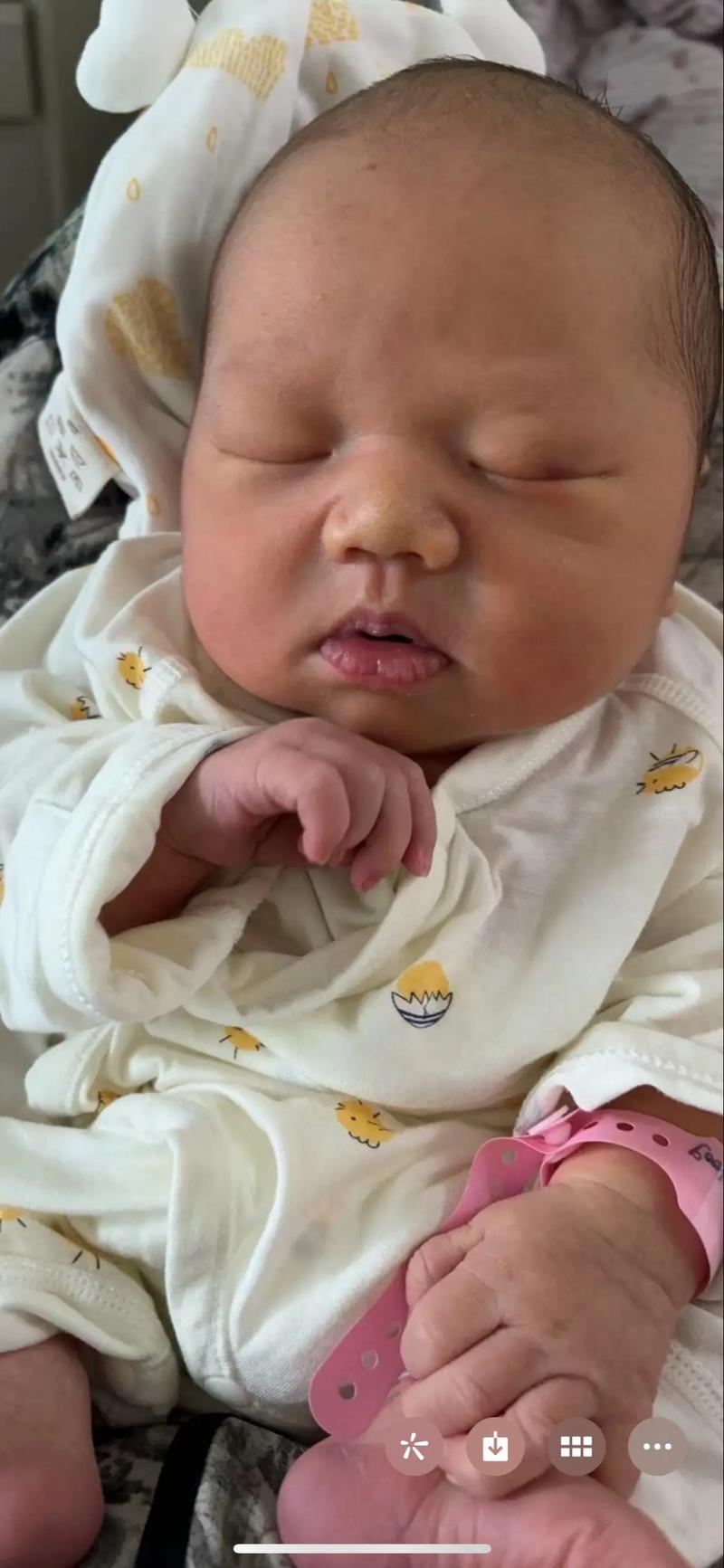 新生儿总胆红素100μmol/L需要干预吗?对宝宝有影响吗?-第2张图片-郑州医学网 新生儿总胆红素100μmol/L需要干预吗?对宝宝有影响吗?-第2张图片-郑州医学网