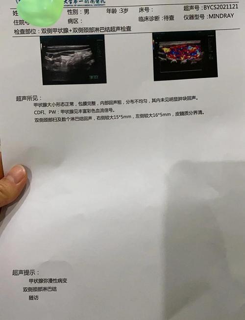 新生儿甲状腺检查异常，到底意味着什么？需要家长如何应对？-第3张图片-郑州医学网