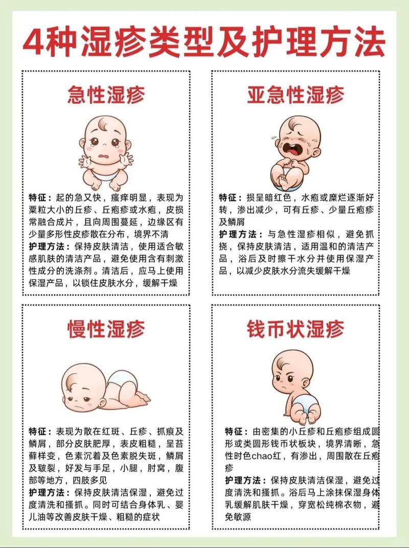 儿童全身湿疹反复发作,该如何科学治疗才能止痒又防复发?-第1张图片-郑州医学网 儿童全身湿疹反复发作,该如何科学治疗才能止痒又防复发?-第1张图片-郑州医学网