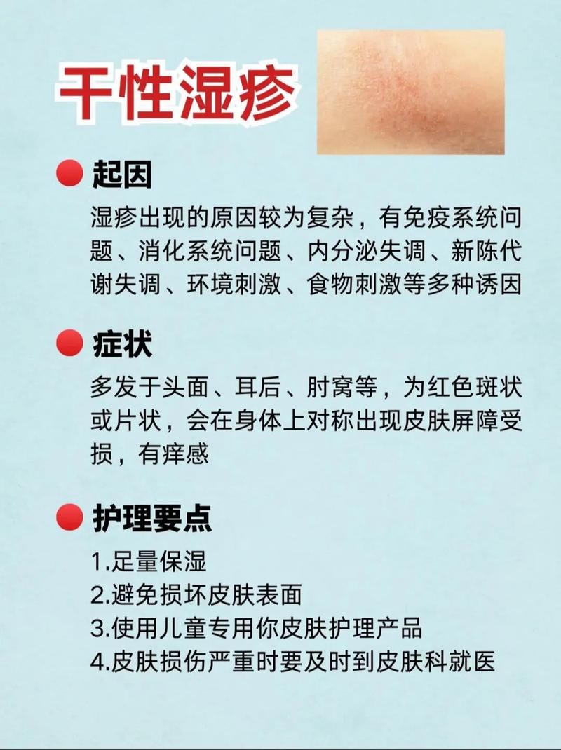 儿童全身湿疹反复发作，该如何科学治疗才能止痒又防复发？-第2张图片-郑州医学网