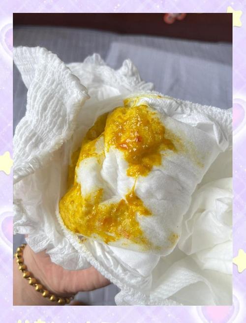 新生儿黄疸血液检测数值210μmol/L需要立即干预治疗吗？-第2张图片-郑州医学网