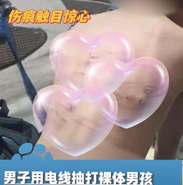 怀孕期间遭遇家暴，为何男友的拳头能挥向最该被保护的人？-第2张图片-郑州医学网