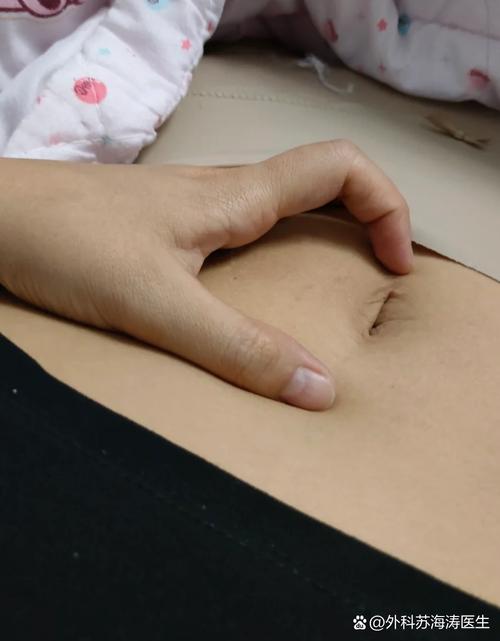 孕期肚子有一块硬硬的是怎么回事？对胎儿有影响吗？-第3张图片-郑州医学网