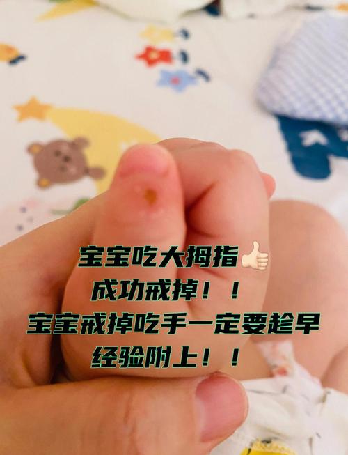 儿童睡觉时手指频繁抖动是正常生理现象还是潜在健康信号?-第1张图片-郑州医学网 儿童睡觉时手指频繁抖动是正常生理现象还是潜在健康信号?-第1张图片-郑州医学网