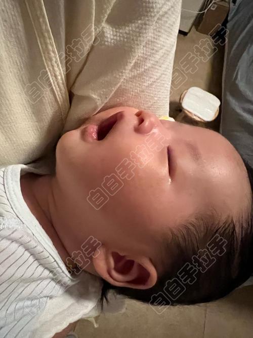 新生儿一个月眼白发黄是正常现象还是黄疸信号？需如何处理？-第2张图片-郑州医学网