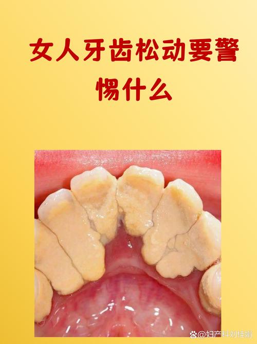 孕期烤瓷牙松动，会不会影响胎儿健康？该如何安全处理？-第2张图片-郑州医学网