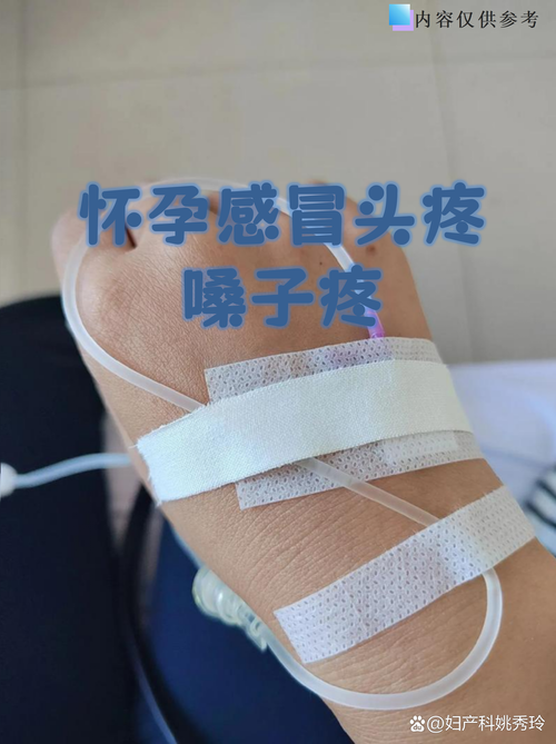 孕期喉咙痛头疼怎么办？孕期喉咙痛头疼会影响胎儿吗？-第2张图片-郑州医学网