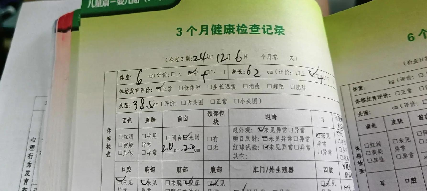 新生儿三个月体检都查哪些项目？家长需要提前做哪些准备？-第2张图片-郑州医学网