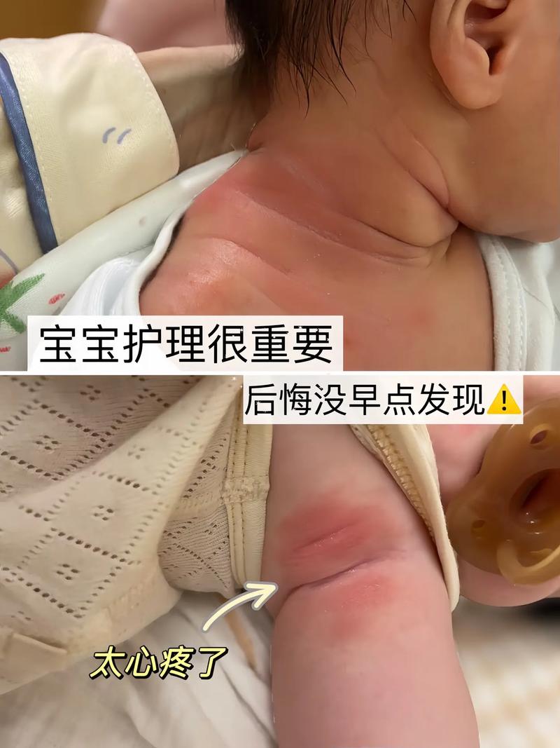 万金油对新生儿的伤害-第1张图片-郑州医学网 万金油对新生儿的伤害-第1张图片-郑州医学网