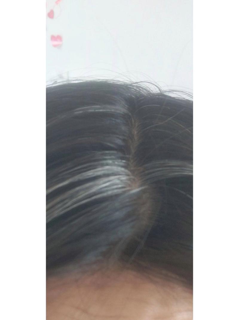 孕期白头发增多是激素变化还是营养缺失？孕期白发骤增背后的健康信号解读-第3张图片-郑州医学网