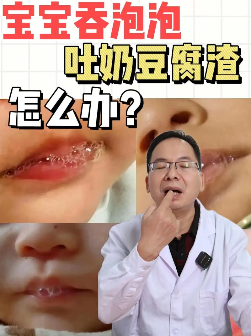 新生儿吐出豆腐渣样物质是消化问题还是疾病信号？-第1张图片-郑州医学网