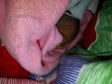 为什么新生儿女婴外生殖器图片需要公开，其拍摄和使用应遵循哪些伦理规范？-第1张图片-郑州医学网