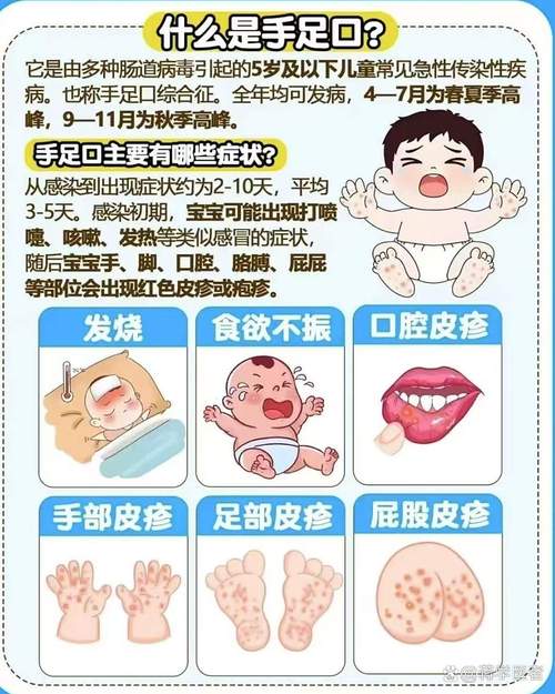 儿童手足口病究竟通过哪些日常接触悄悄传染给孩子？-第2张图片-郑州医学网