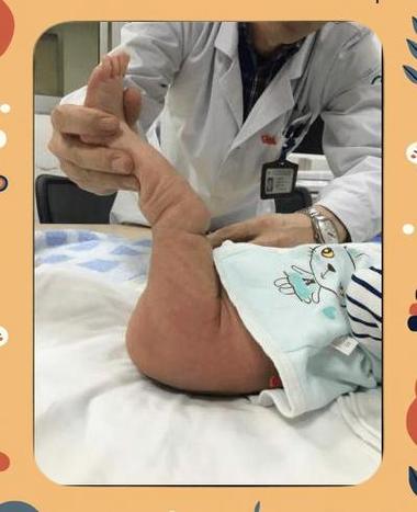 新生儿膝盖骨头响是正常发育现象还是骨骼异常信号？-第2张图片-郑州医学网