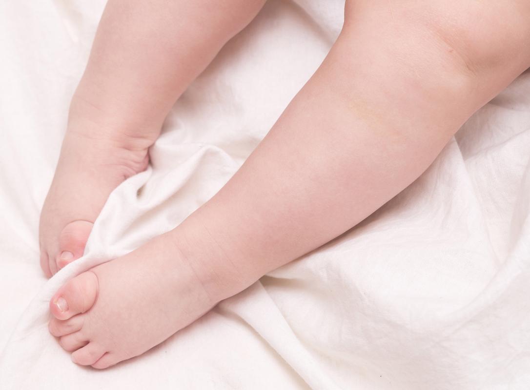 新生儿膝盖骨头响是正常发育现象还是骨骼异常信号？-第3张图片-郑州医学网