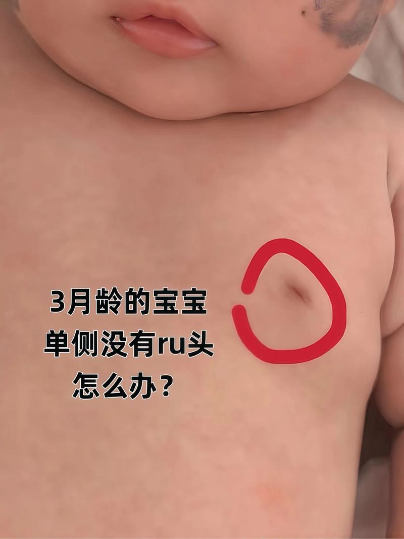 新生儿第一天没母乳,妈妈该咋办?宝宝会不会饿坏?-第1张图片-郑州医学网 新生儿第一天没母乳,妈妈该咋办?宝宝会不会饿坏?-第1张图片-郑州医学网