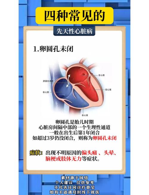 儿童医院先天性心脏病治疗现状与未来突破方向如何？-第2张图片-郑州医学网