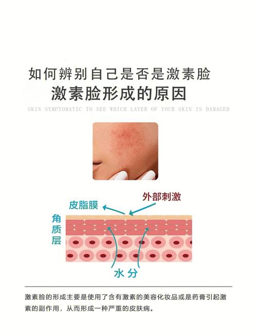 孕期激素脸反反复复,到底该怎么安全护理才能好?-第2张图片-郑州医学网 孕期激素脸反反复复,到底该怎么安全护理才能好?-第2张图片-郑州医学网