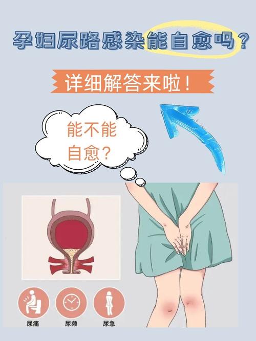 孕期为何易尿道感染?激素变化与子宫压迫如何作祟?-第2张图片-郑州医学网 孕期为何易尿道感染?激素变化与子宫压迫如何作祟?-第2张图片-郑州医学网