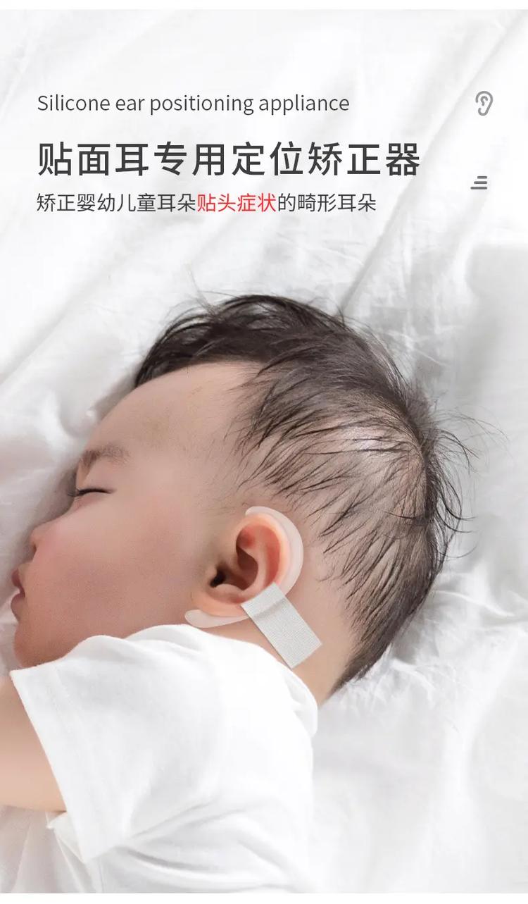 新生儿一只耳朵招风耳需要干预吗?会影响听力或后续发育吗?-第1张图片-郑州医学网 新生儿一只耳朵招风耳需要干预吗?会影响听力或后续发育吗?-第1张图片-郑州医学网