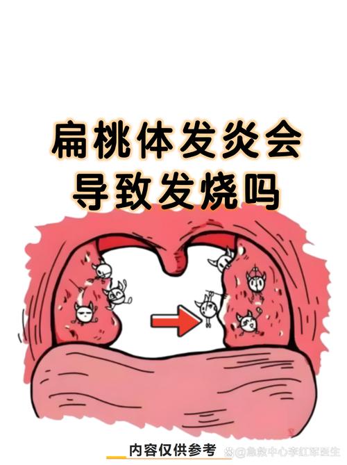 备孕期扁桃体发炎发烧会影响怀孕吗？需要用药治疗吗？-第2张图片-郑州医学网