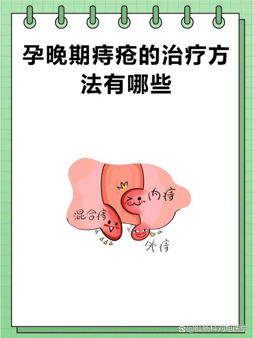 孕期痔疮可以做手术吗-第2张图片-郑州医学网